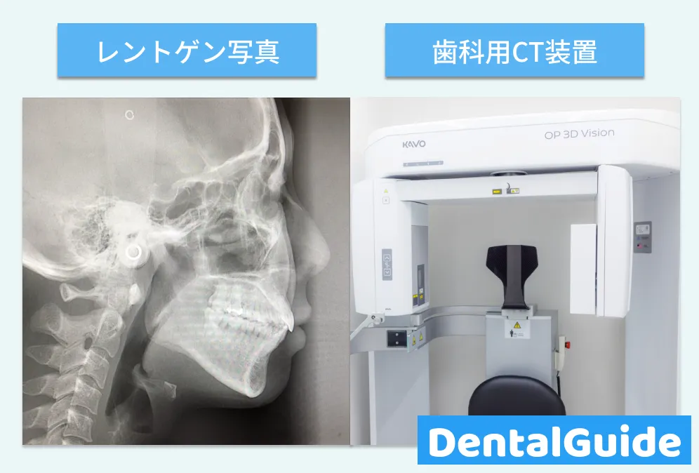 レントゲン写真と歯科用CT